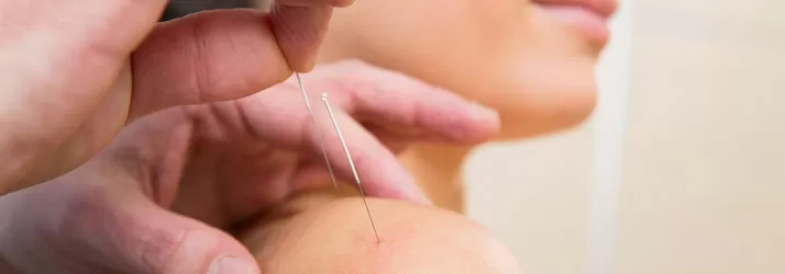 Chiropractic Gilbert AZ Dry Needling